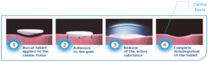 Dosing & Administration | Sitavig (acyclovir), 50mg Muco-Adhesive ...